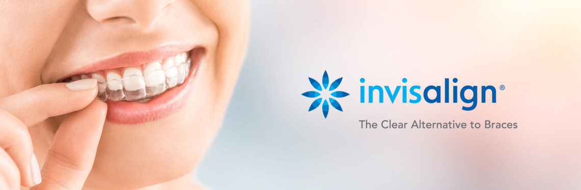 Invisalign – Dr. Stone Dentistry